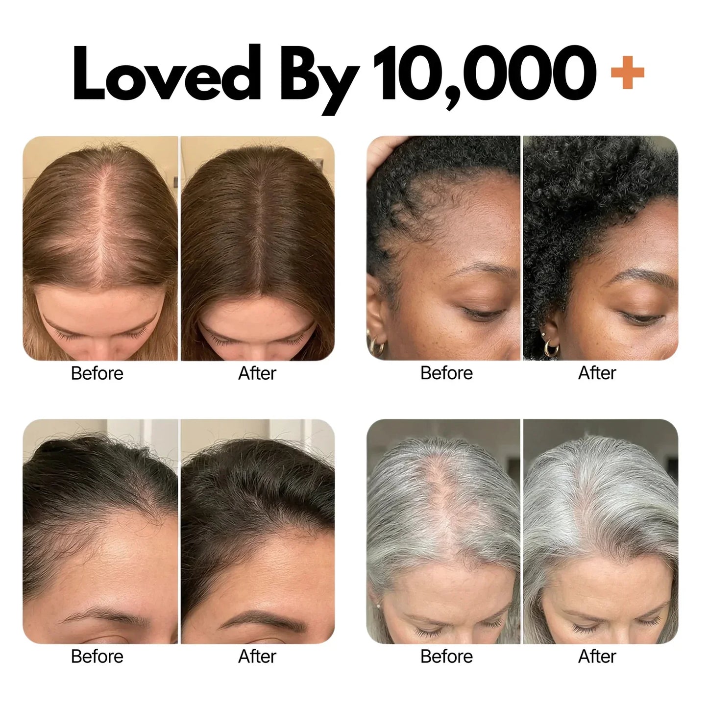 Lazzda Hair Growth Serum
