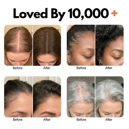 Lazzda Hair Growth Serum