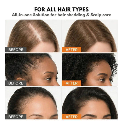 Lazzda Hair Growth Serum