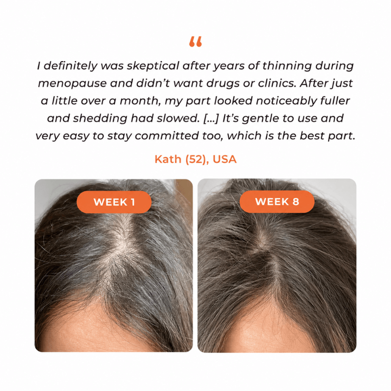 Lazzda Hair Growth Serum