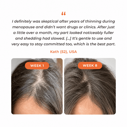 Lazzda Hair Growth Serum